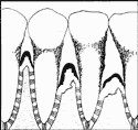periodontal-disease-tempe-az